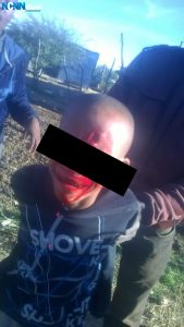 CHILD_SHOT_IN_CROSSFIRE_BETWEEN_ARTISANAL_MINERS_AND_SECURITY-20180531-NEW